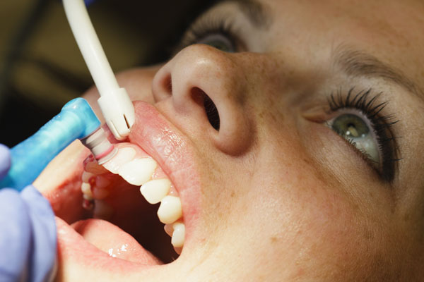 Periodontal Treatment